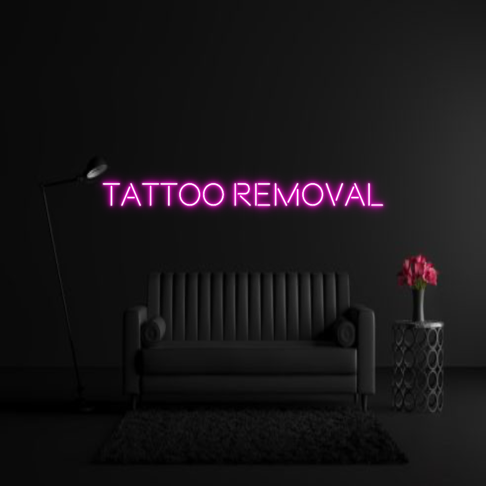 CREATE YOUR OWN WEDDING NEON SIGN Tattoo Removal